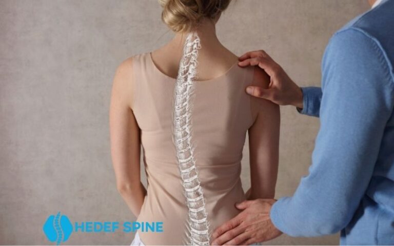 3d Skolyoz Korsesi ile Sağlıklı Bir Duruşa Kavuşun